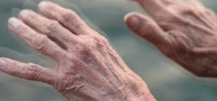 o-que-e-doenca-de-parkinson-blog-green-house-senior